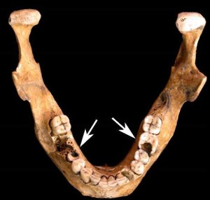 agriculturaljawbone